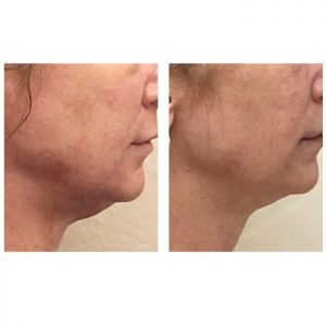 agnes-before-and-after-photo12
